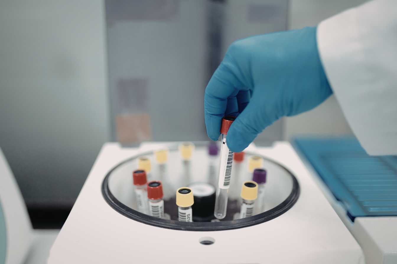 albumine-dans-le-sang-tout-savoir-sur-votre-taux-et-ce-qu-il-revele-guide-2