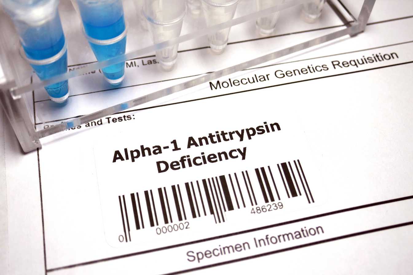 alpha 1 globuline 1