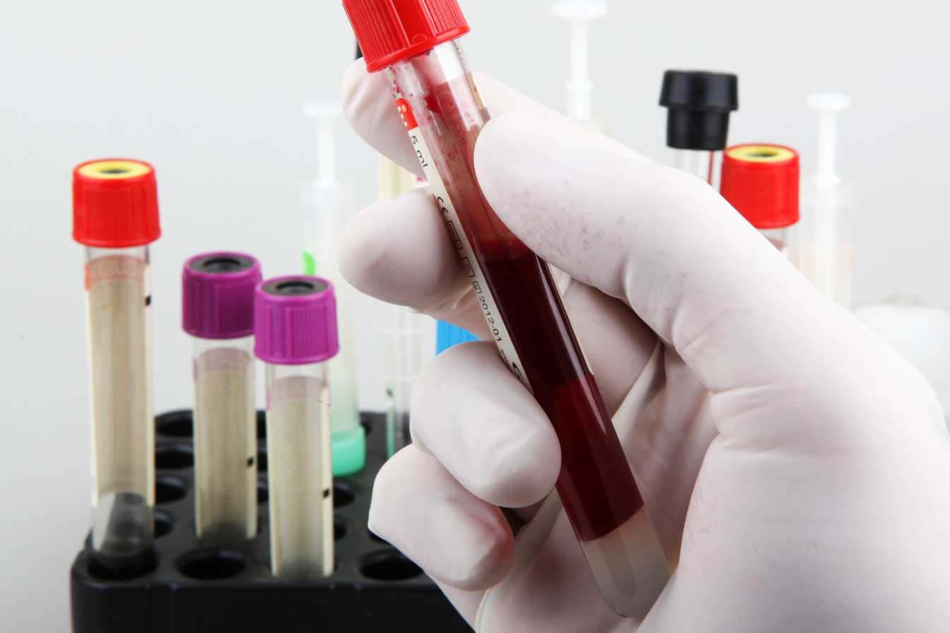 ccmh-prise-de-sang-3