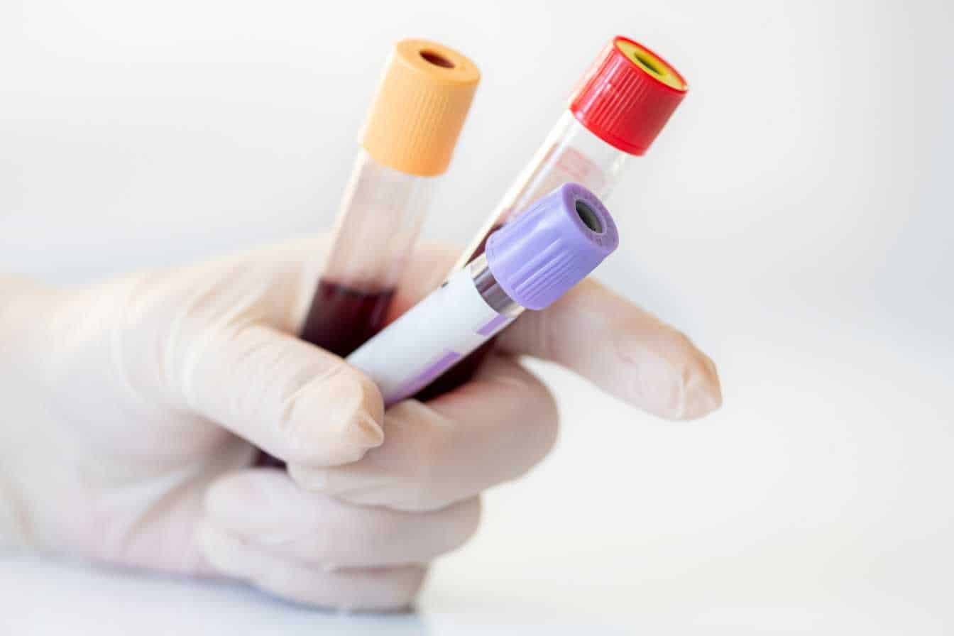 chlore-dans-le-sang-role-valeurs-normales-et-anomalies-a-connaitre-2