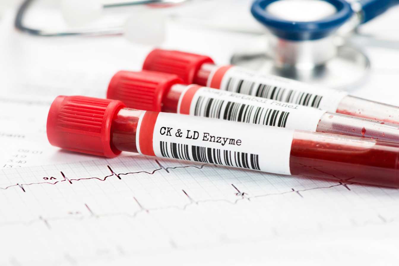 combien-coute-une-prise-de-sang-3