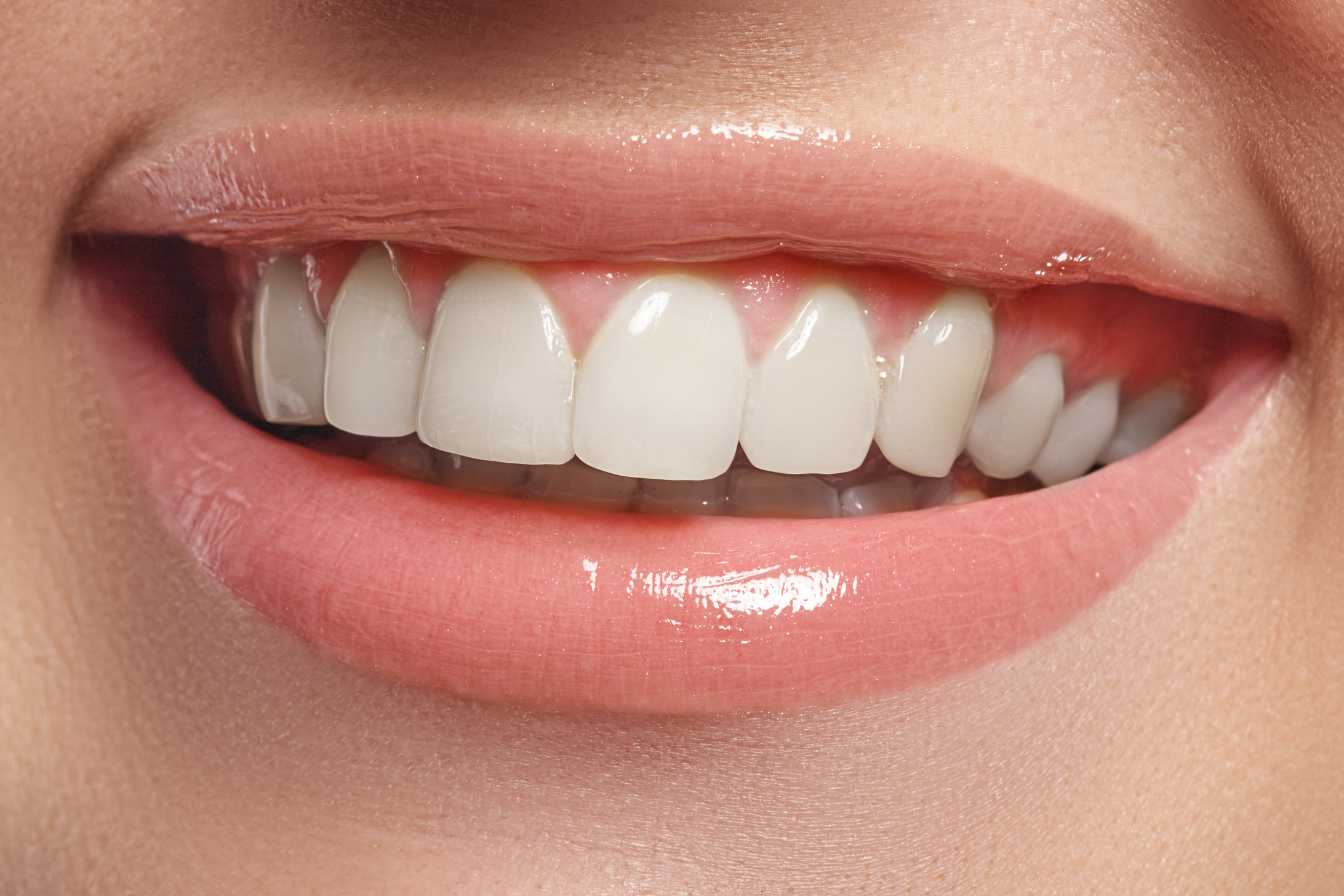 comment avoir les dents plus blanches chez soi 1