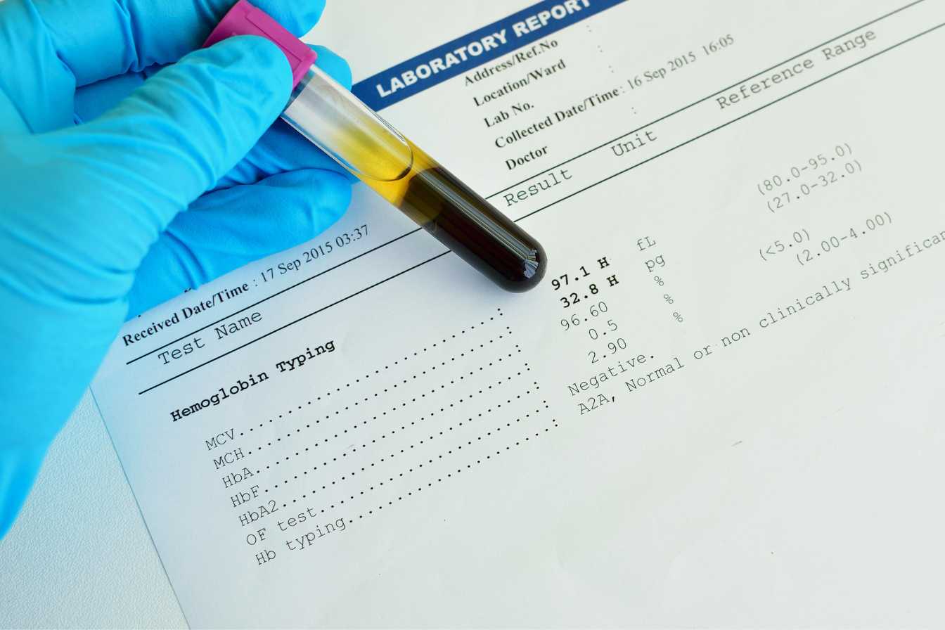 comment-faire-baisser-l-hemoglobine-glyquee-2