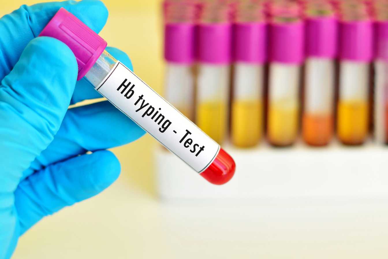 comment-faire-baisser-l-hemoglobine-glyquee-3