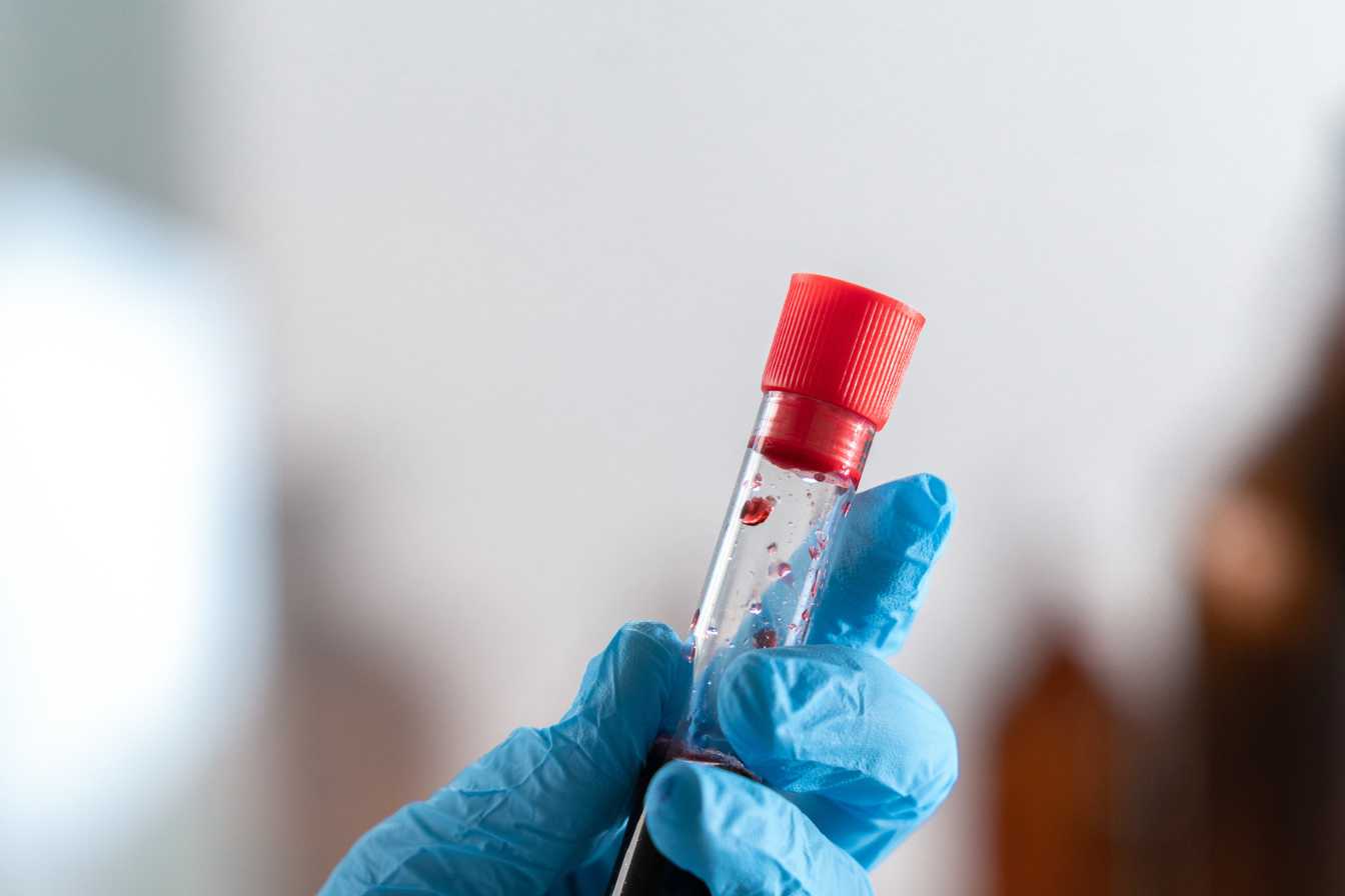 cortisol prise de sang guide complet sur le dosage et l interpretation des resultats 1