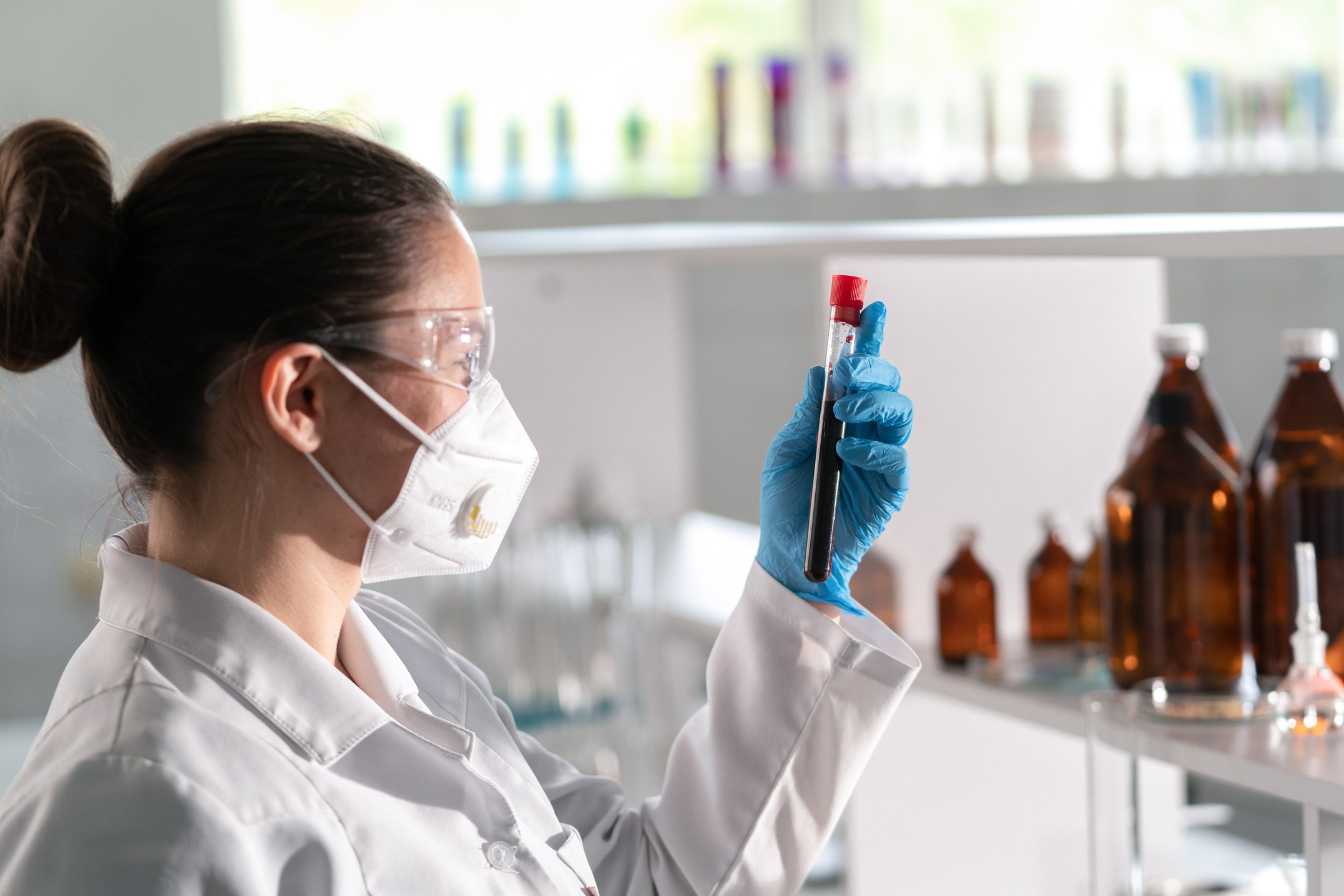 creatinine-dans-la-prise-de-sang-tout-savoir-sur-ce-marqueur-cle-de-la-sante-renale-2