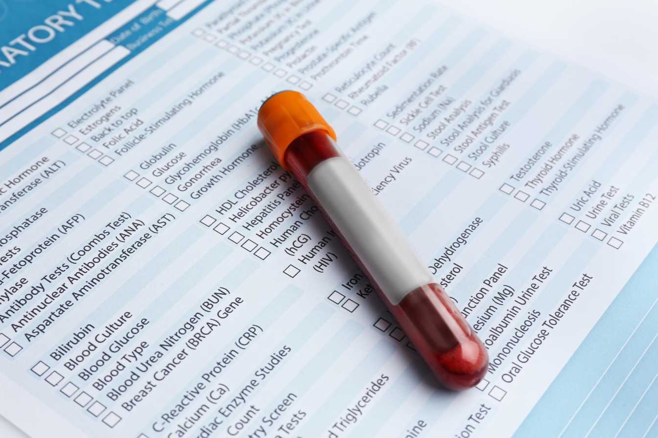 creatinine-dans-la-prise-de-sang-tout-savoir-sur-ce-marqueur-cle-de-la-sante-renale-3