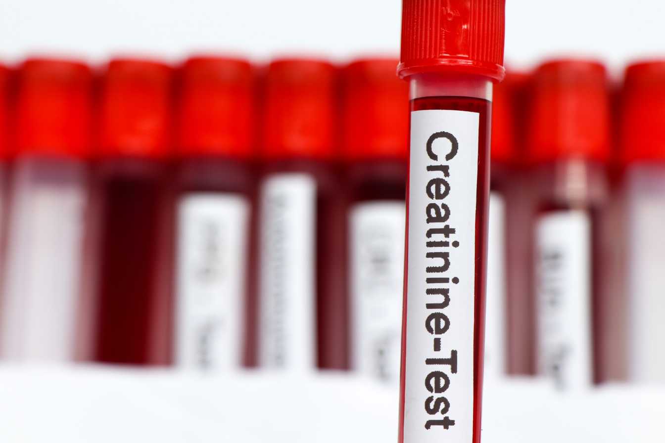 creatinine-prise-de-sang-2