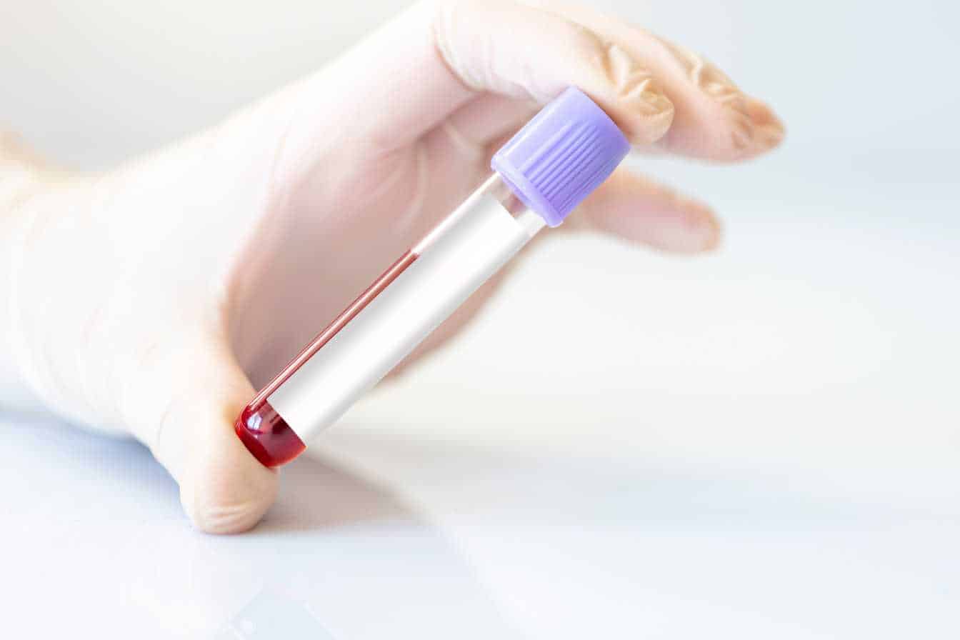 faut il etre a jeun pour ferritine 1