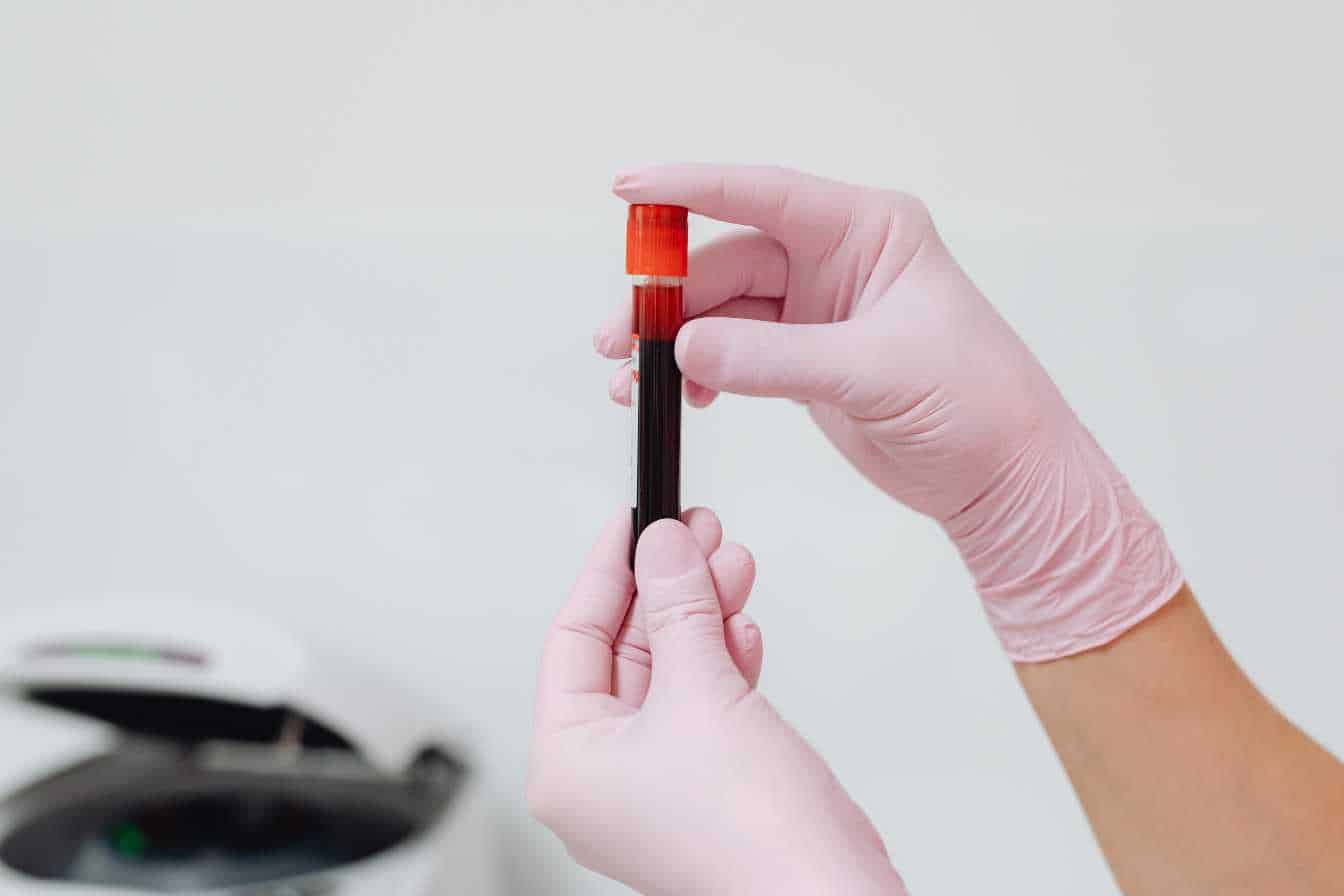 gaj prise de sang tout ce qu il faut savoir sur la glycemie a jeun 1