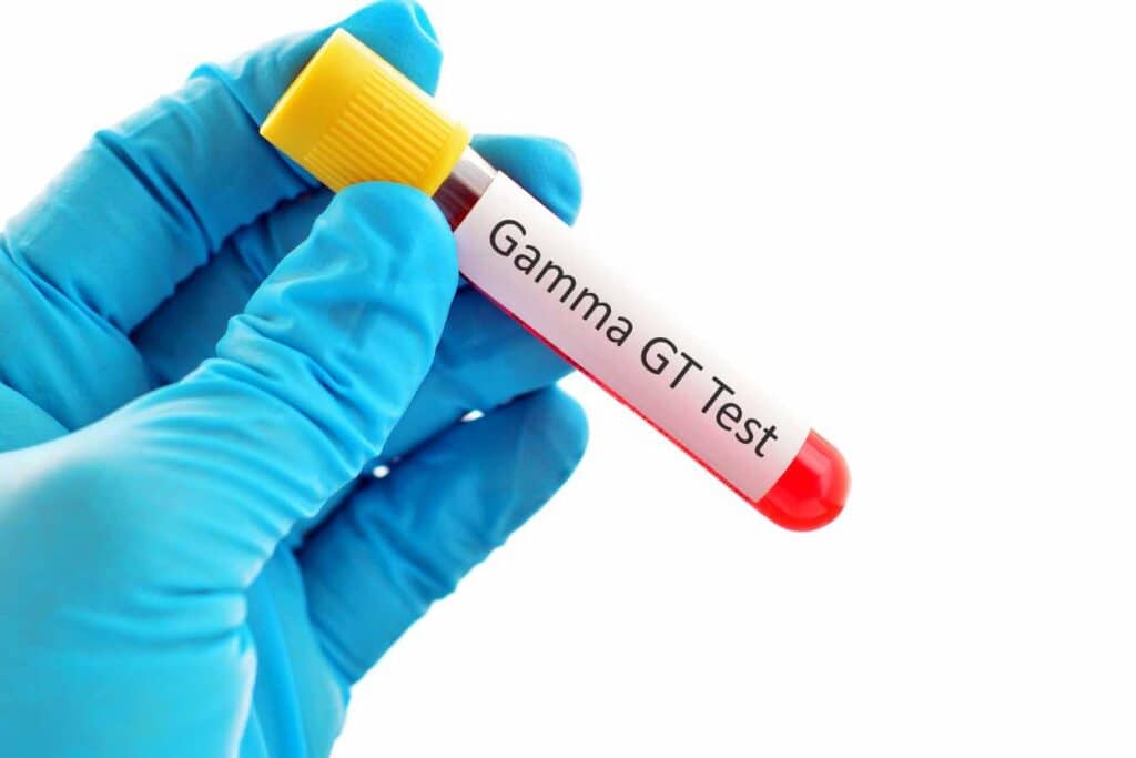 Gamma GT Élevé Causes, Symptômes et Astuces pour Réduire Rapidement — free download