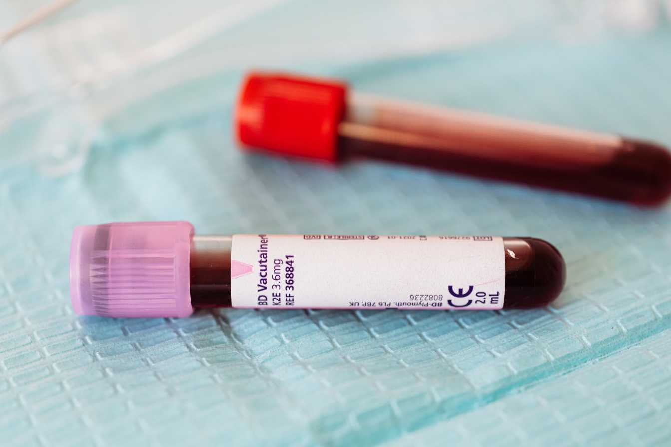 hba1c-prise-de-sang-ce-que-revele-votre-test-et-comment-l-ameliorer-2