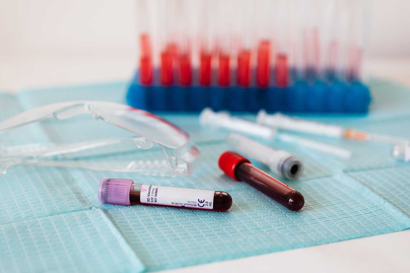 hba1c-prise-de-sang-ce-que-revele-votre-test-et-comment-l-ameliorer-3