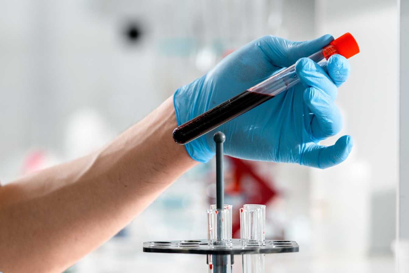 hematocrite et vgm comprendre ces indicateurs cles de votre sante sanguine 1