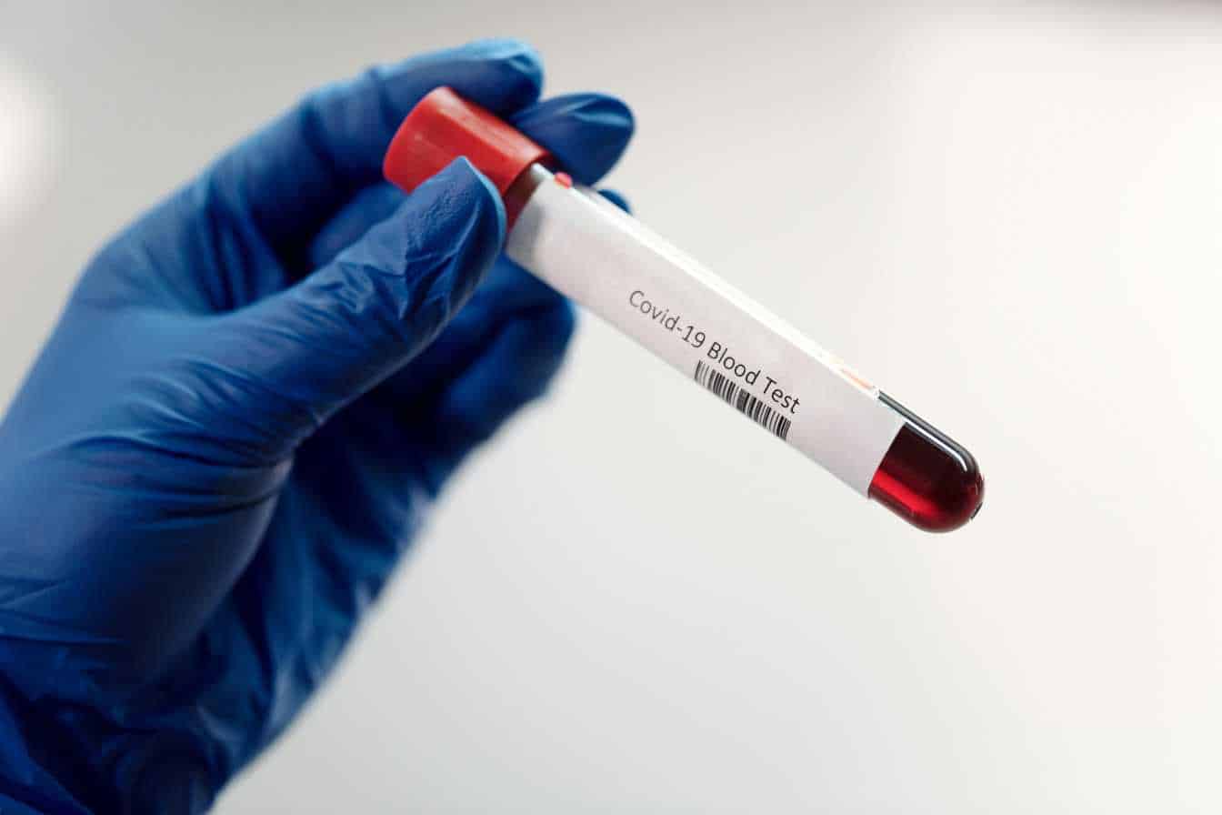 hematocrite-et-vgm-comprendre-ces-indicateurs-cles-de-votre-sante-sanguine-2