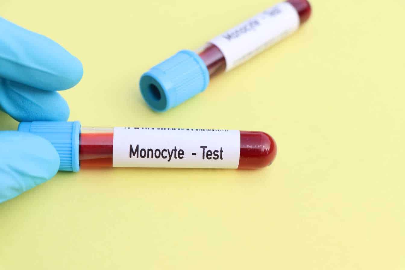 monocytes bas causes symptomes et solutions pour remonter vos taux 1