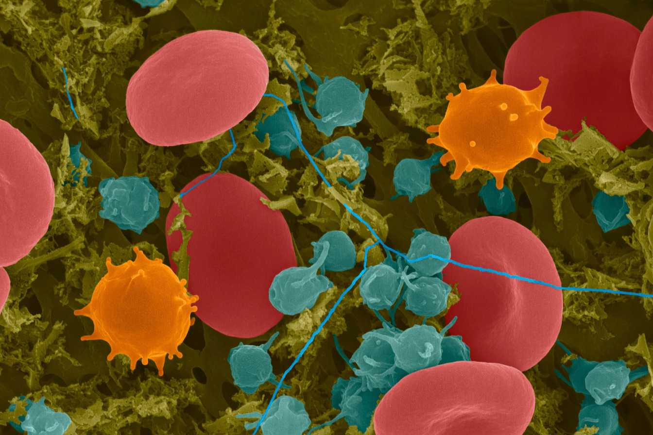 monocytes-bas-causes-symptomes-et-solutions-pour-remonter-vos-taux-2