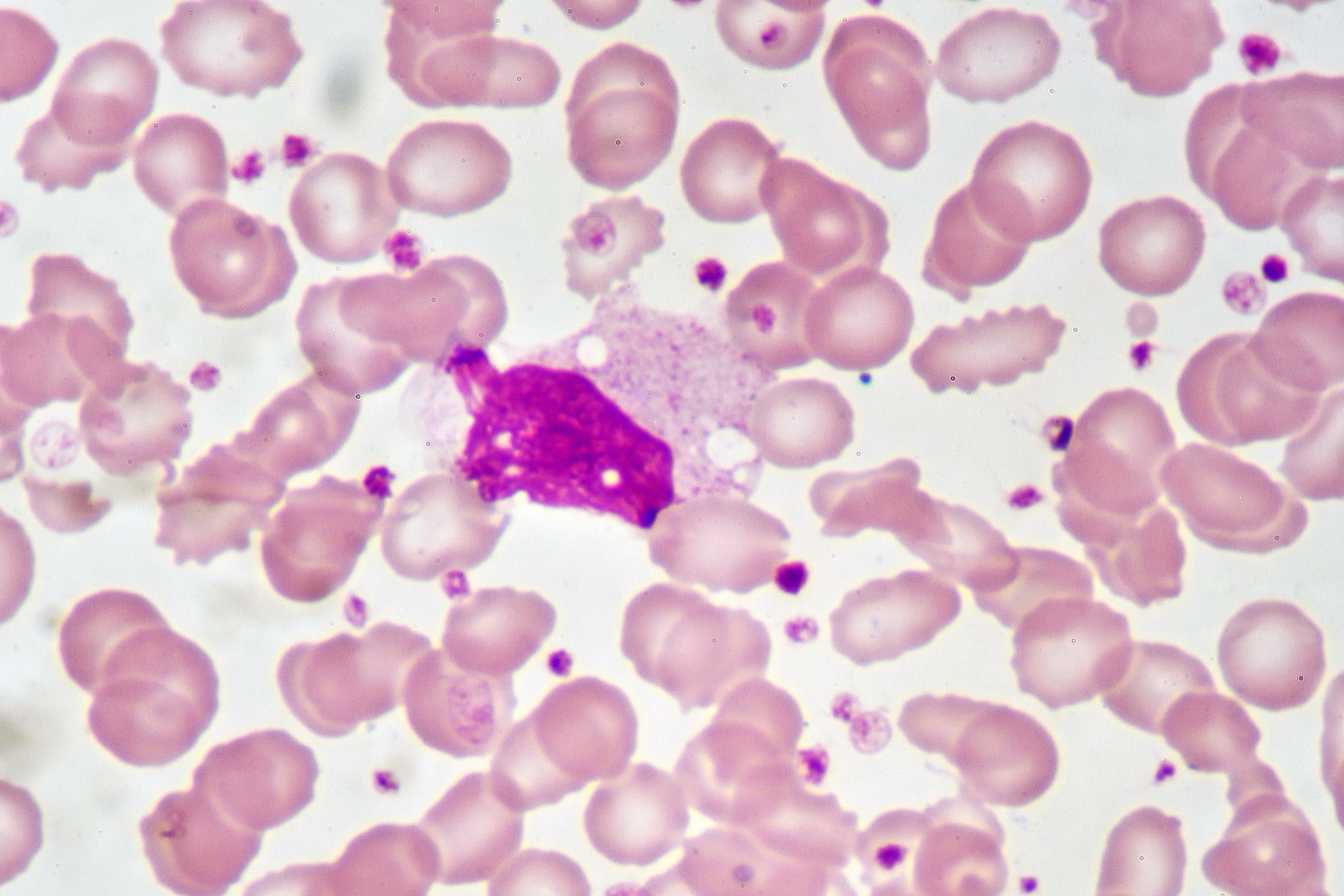 monocytes-bas-causes-symptomes-et-solutions-pour-remonter-vos-taux-3
