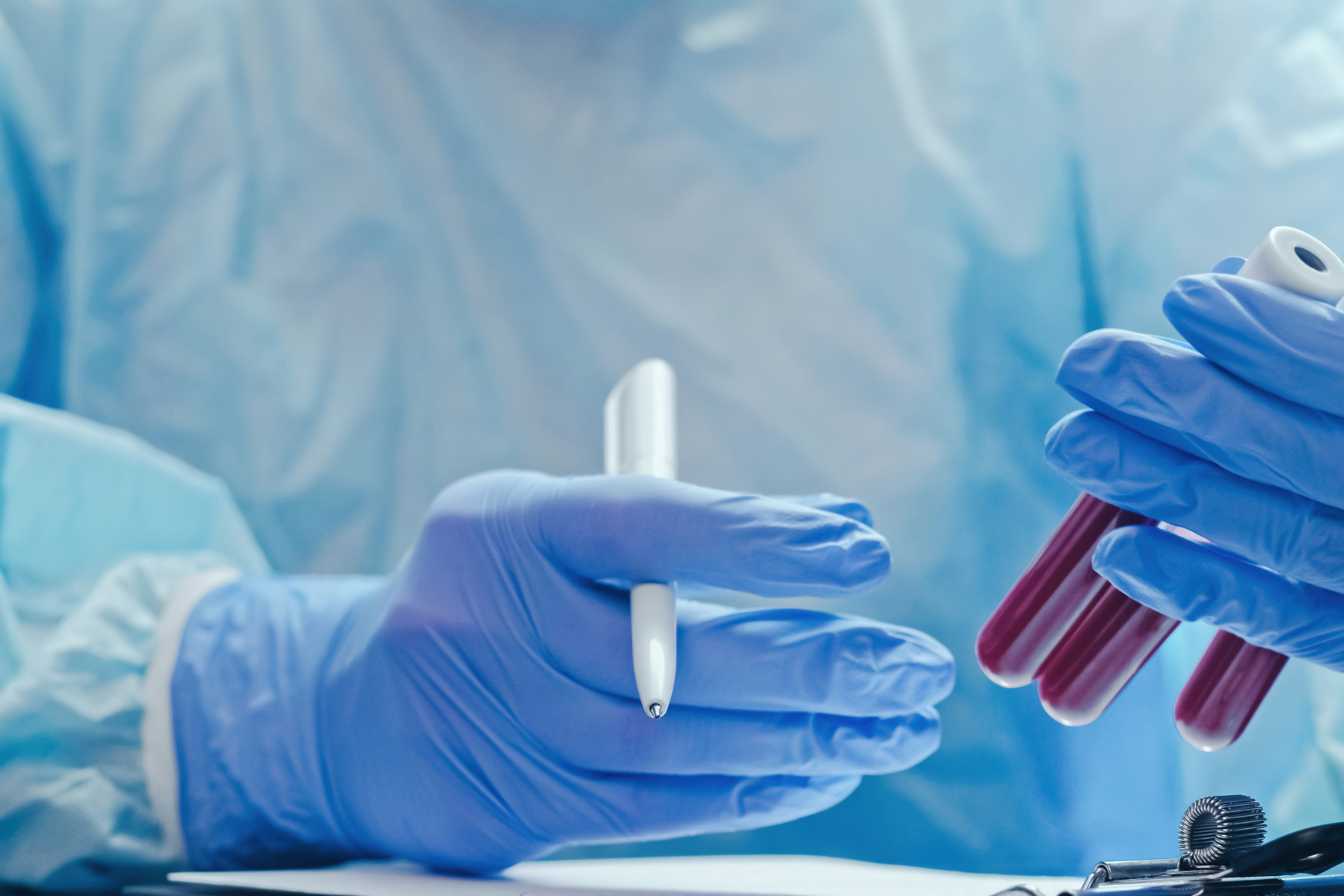 monocytes prise de sang comprendre vos resultats et agir en consequence 1