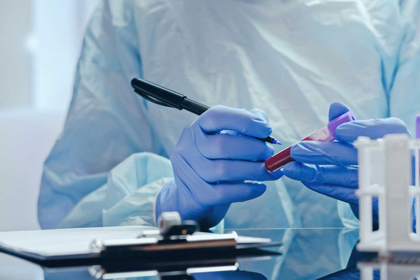 monocytes-prise-de-sang-comprendre-vos-resultats-et-agir-en-consequence-2