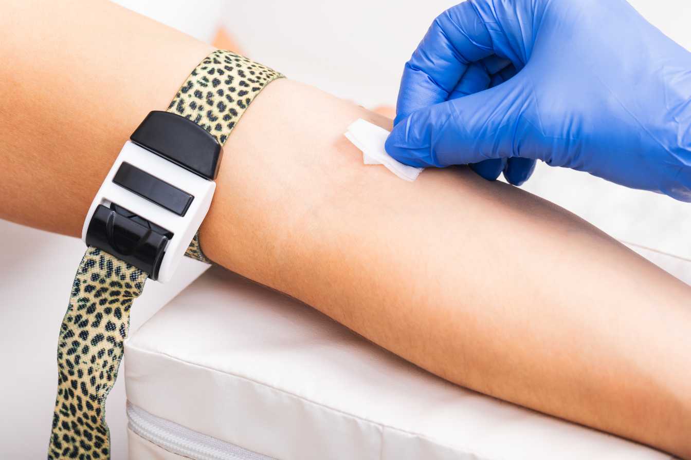 peut-on-fumer-avant-une-prise-de-sang-2