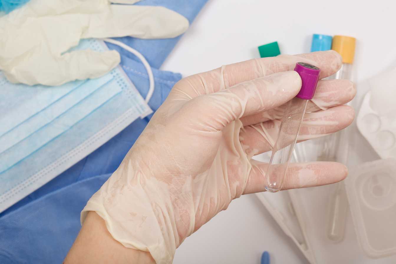 peut-on-fumer-avant-une-prise-de-sang-3