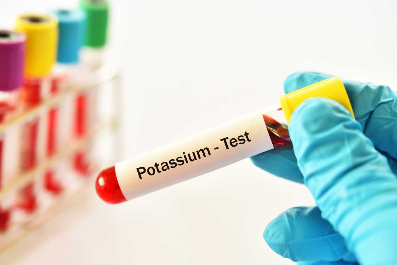 potassium-dans-le-sang-ce-que-chaque-francais-doit-savoir-sur-ce-mineral-vital-3