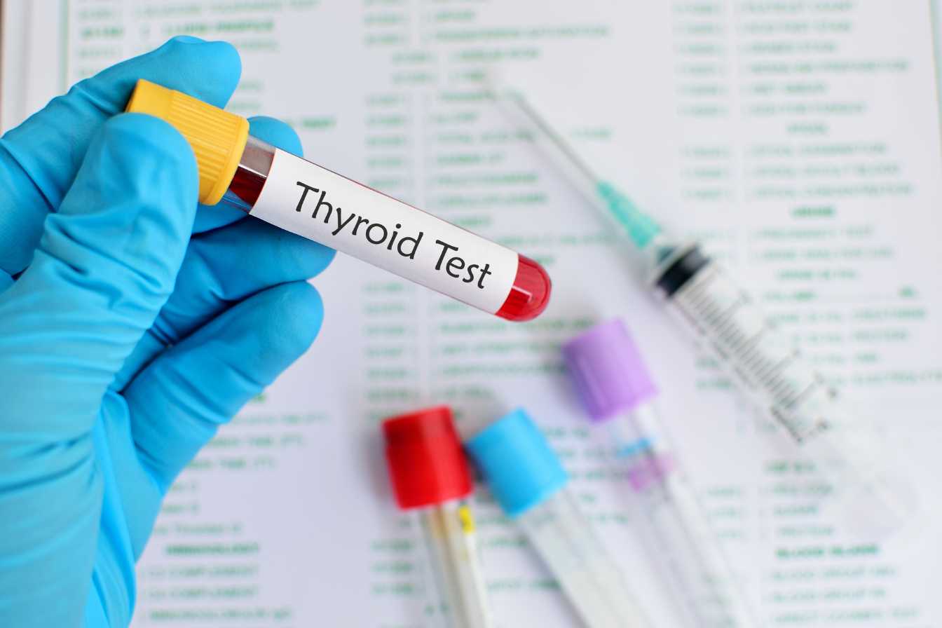 prise de sang thyroide guide complet 2026 pour comprendre votre bilan 1