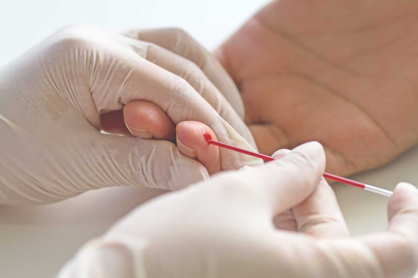 quel taux d hematocrite est inquietant seuils risques et signaux d alerte 1
