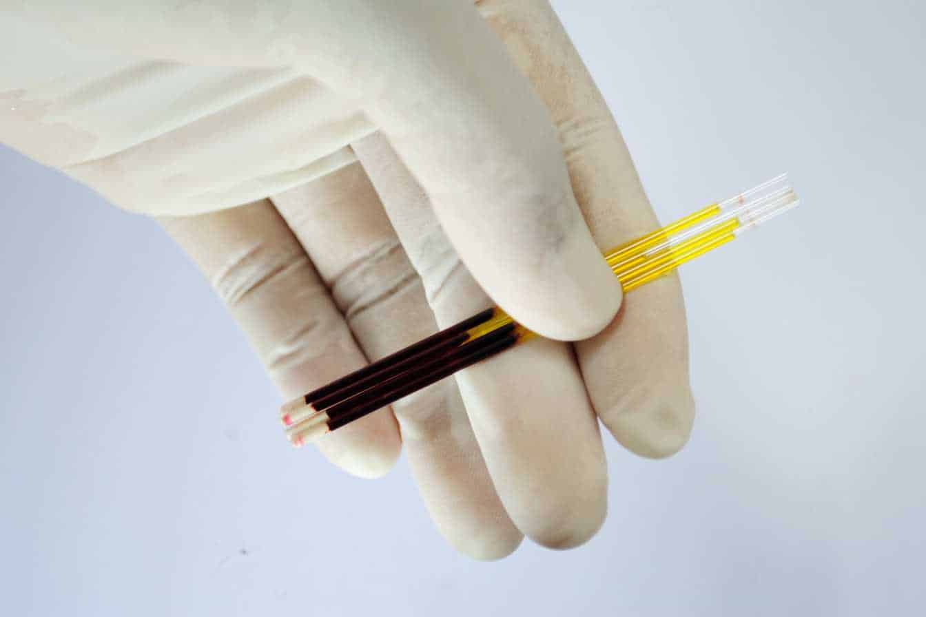 quel-taux-d-hematocrite-est-inquietant-seuils-risques-et-signaux-d-alerte-2