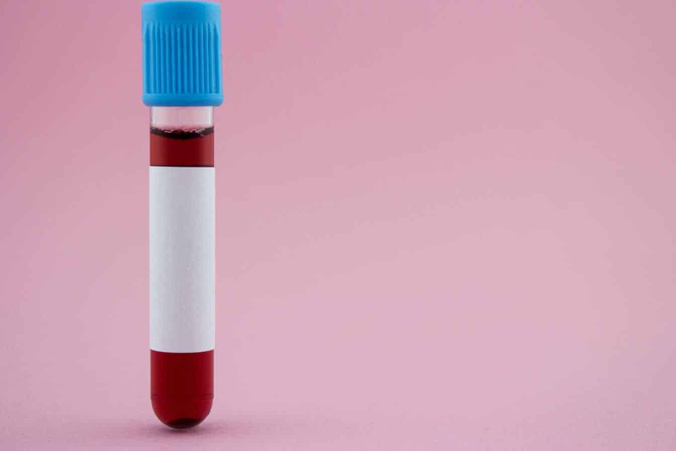 quel taux de ccmh est alarmant 1