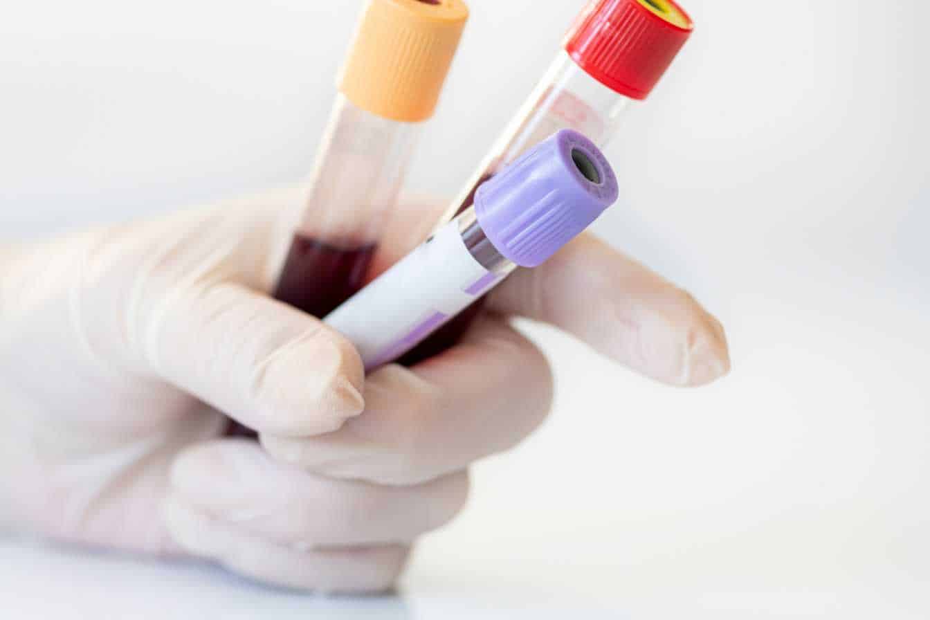 quel-taux-de-ccmh-est-alarmant-3