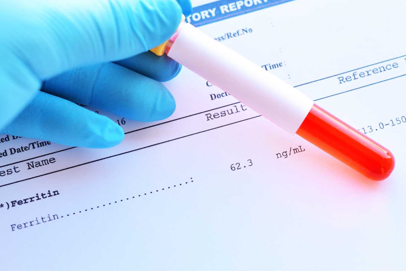 quel taux de ferritine pour un cancer 1