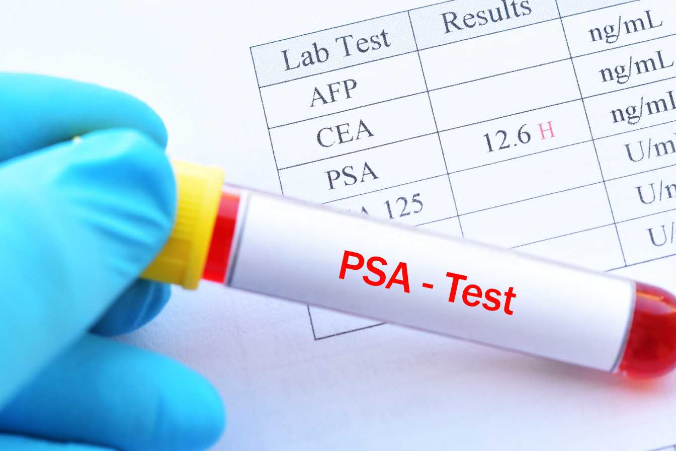 quel-taux-de-ferritine-pour-un-cancer-2