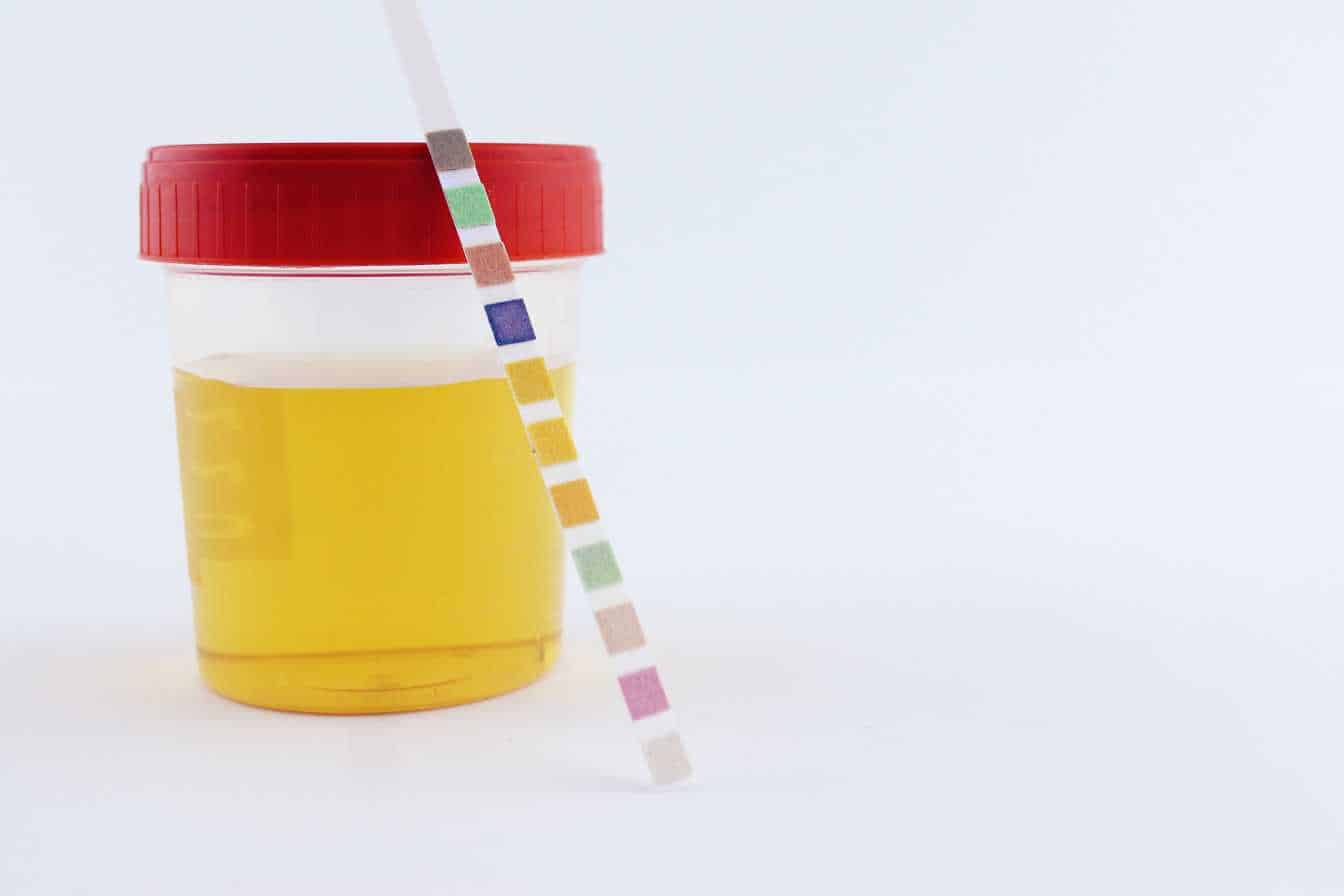 quelle maladie provoque du sang dans les urines 1