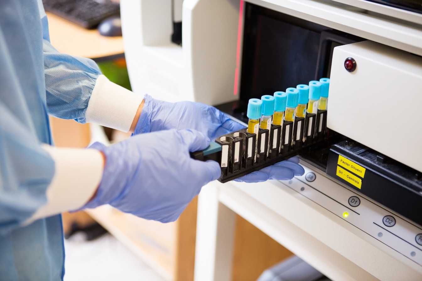 tca-prise-de-sang-tout-savoir-sur-le-test-de-coagulation-2