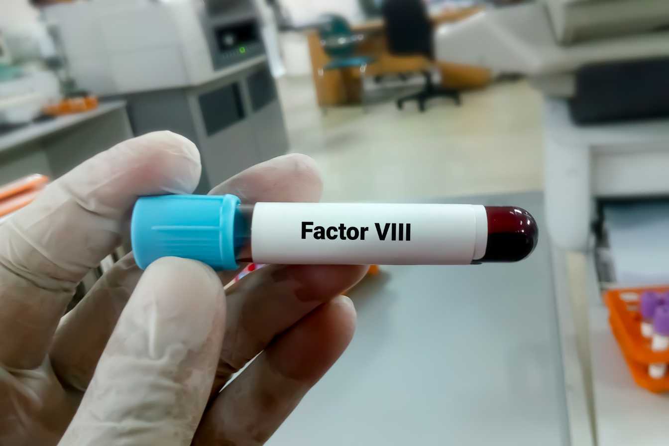 tca-prise-de-sang-tout-savoir-sur-le-test-de-coagulation-3