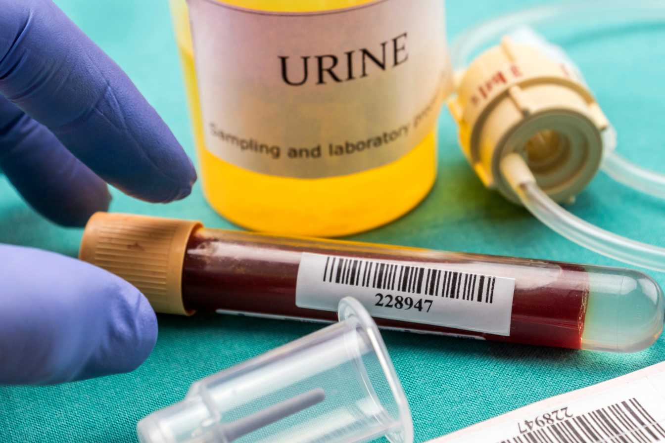 uriner-du-sang-homme-causes-symptomes-et-quand-s-inquieter-vraiment-3